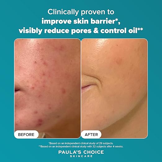 Paula's Choice SKIN PERFECTING 2% BHA Liquid Exfoliant - Face Exfoliating Peel Fights Blackheads & Enlarged Pores - with Salicylic Acid - Combination & Oily Skin - 118 ml