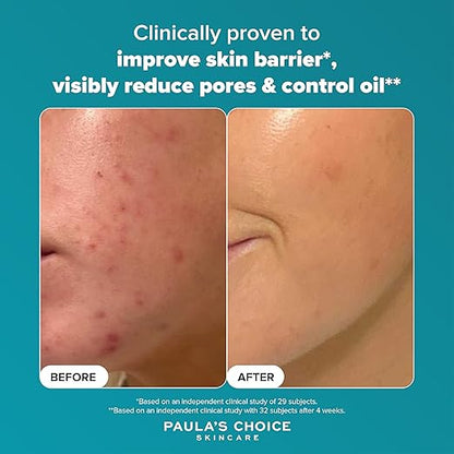 Paula's Choice SKIN PERFECTING 2% BHA Liquid Exfoliant - Face Exfoliating Peel Fights Blackheads & Enlarged Pores - with Salicylic Acid - Combination & Oily Skin - 118 ml